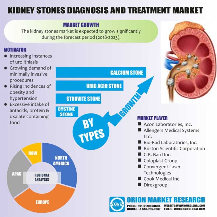 kidney stones treatment